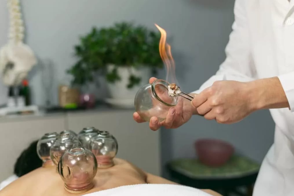 Discover the Healing Power of Dry Cupping Therapy